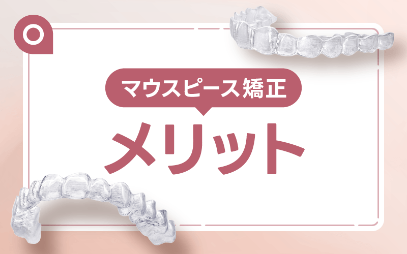マウスピース矯正 メリット