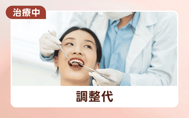 マウスピース矯正 値段 調整代