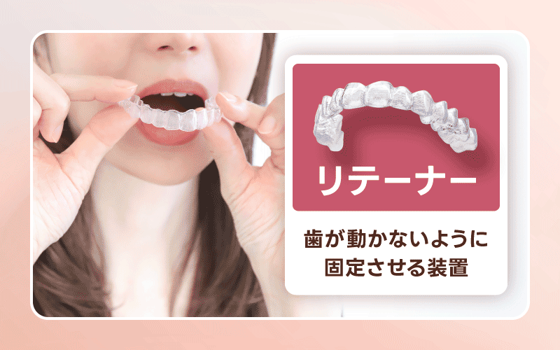 リテーナー