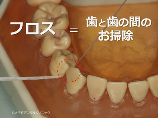 デンタルフロスを使う理由