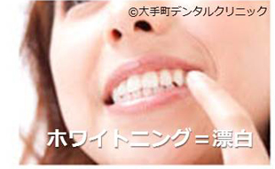 歯のホワイトニングイメージ