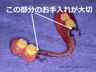 入れ歯のお手入れの仕方のポイント