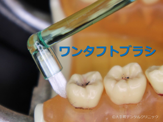 大手町の歯科のワンタフトブラシの画像