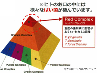 歯周病菌の図