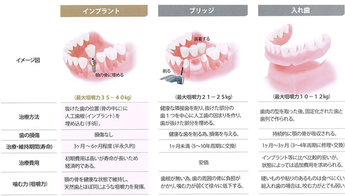 千代田区大手町、東京駅、丸の内のインプラント（03）