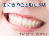 歯周病（歯ぐき）と前歯の関係の写真