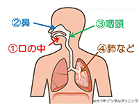 口臭の原因