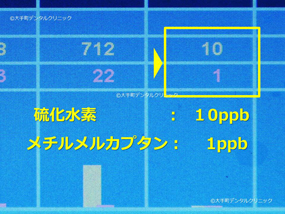 大手町の歯科の口臭治療後のデータ