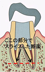 歯の根の治療でおすすめの歯医者１６