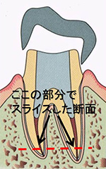 歯の根の治療でおすすめの歯医者１６