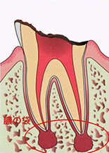 東京で歯の根の治療で有名な歯医者6