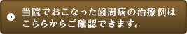 当院でおこなった歯周病の治療例はこちらからご確認できます。