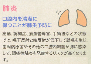 歯周病と肺炎の関係、東京都千代田区の歯科、歯医者（12）