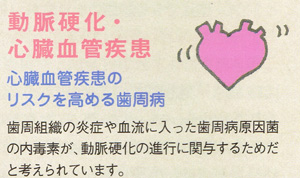 歯周病と心筋梗塞、脳梗塞、狭心症の関係、東京都千代田区の歯科、歯医者（6）