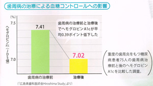 歯周病と糖尿病の関係、東京都千代田区の歯科、歯医者（9）