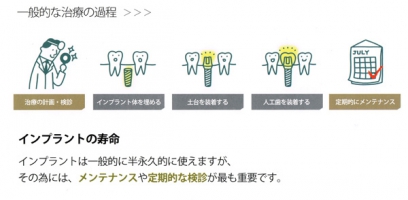 千代田区大手町、東京駅、丸の内のインプラント（３）