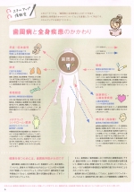 歯周病と全身との関係とは？東京都千代田区の歯科、歯医者（5）